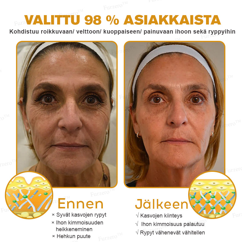 💎🍀Valmistettu ja lähetetty Suomesta ✅Furzero™ Botox-mehiläismyrkky ryppyjä poistava voide