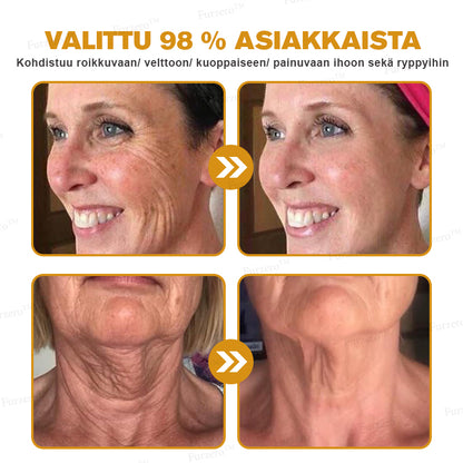 💎🍀Valmistettu ja lähetetty Suomesta ✅Furzero™ Botox-mehiläismyrkky ryppyjä poistava voide