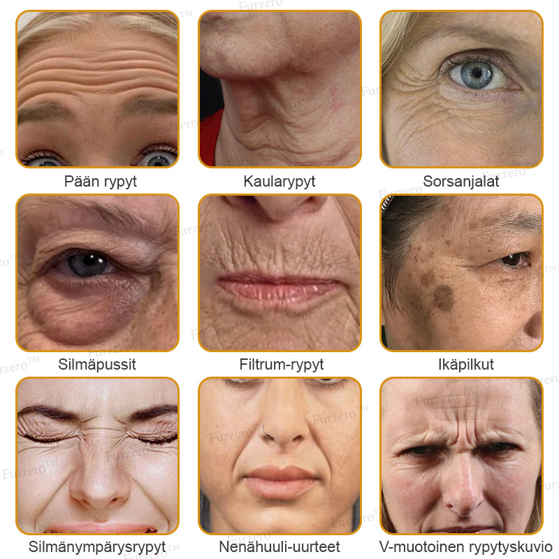 💎🍀Valmistettu ja lähetetty Suomesta ✅Furzero™ Botox-mehiläismyrkky ryppyjä poistava voide