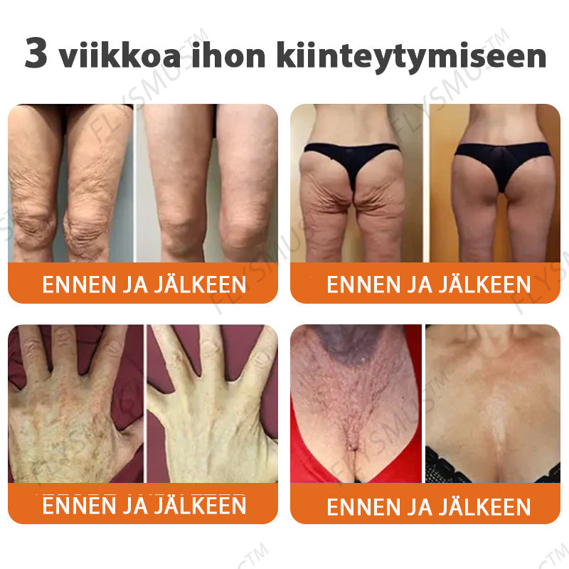 ✅👩‍🔬 Flysmus™ Botox Mehiläismyrkky Kiinteyttävä Seerumipuikko – (Valmistettu ja lähetetty Suomesta) VIIMEINEN PÄIVÄ – 70 % ALENNUS
