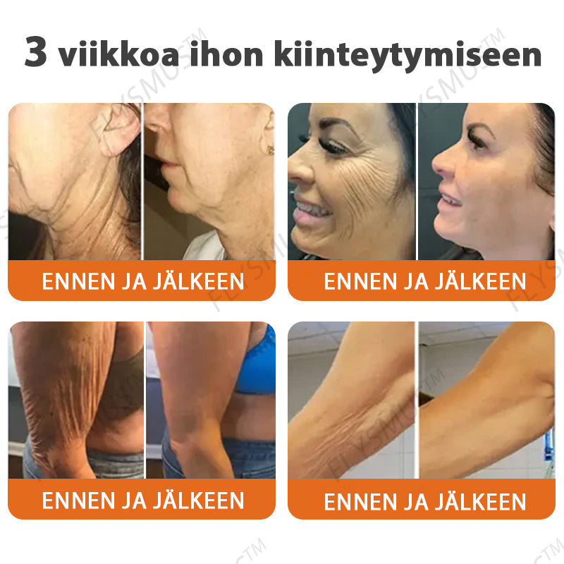 ✅👩‍🔬 Flysmus™ Botox Mehiläismyrkky Kiinteyttävä Seerumipuikko – (Valmistettu ja lähetetty Suomesta) VIIMEINEN PÄIVÄ – 70 % ALENNUS