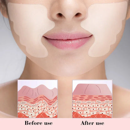 Parches de Silicona Reutilizables para el Contorno Facial | Antiarrugas y Reafirmantes | Para Surcos Nasogenianos | Efecto Lifting y Antienvejecimiento | Cuidado Facial
