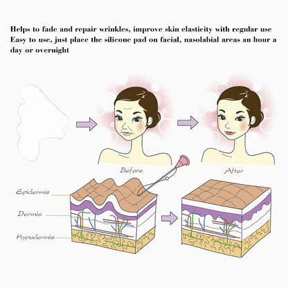 Parches de Silicona Reutilizables para el Contorno Facial | Antiarrugas y Reafirmantes | Para Surcos Nasogenianos | Efecto Lifting y Antienvejecimiento | Cuidado Facial